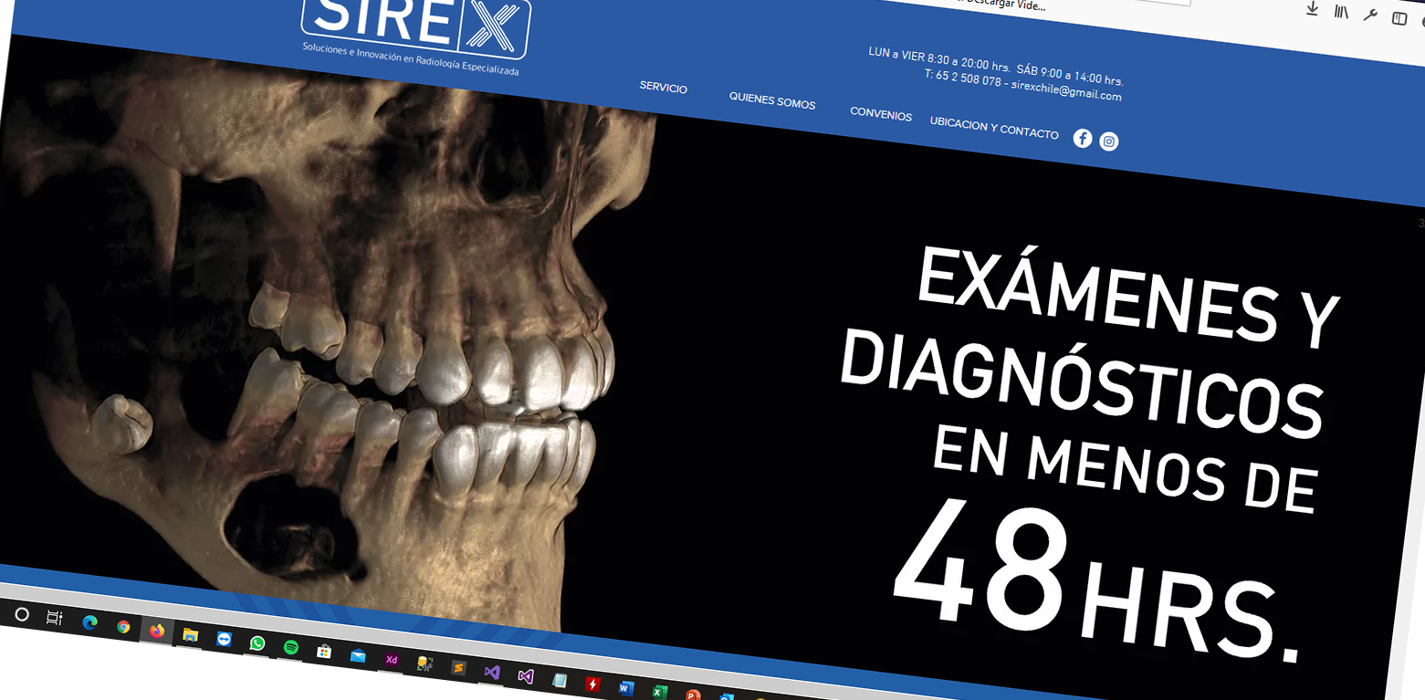 Sirex Chile